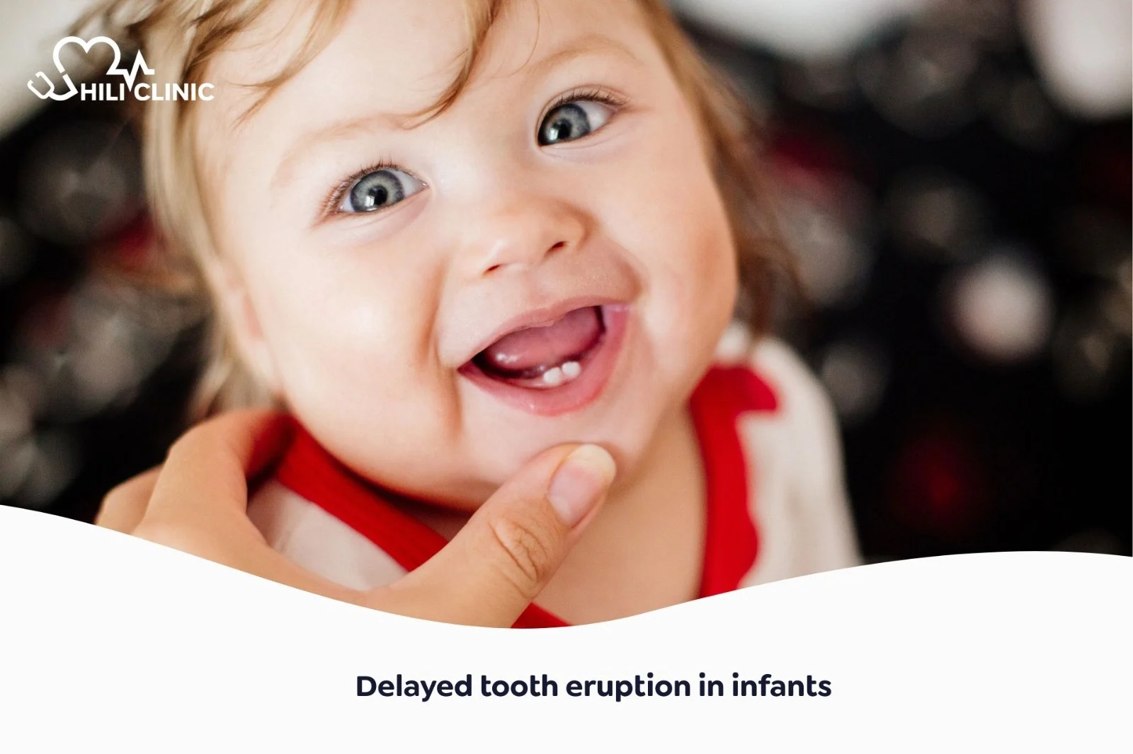 Delayed Tooth Eruption in Infants