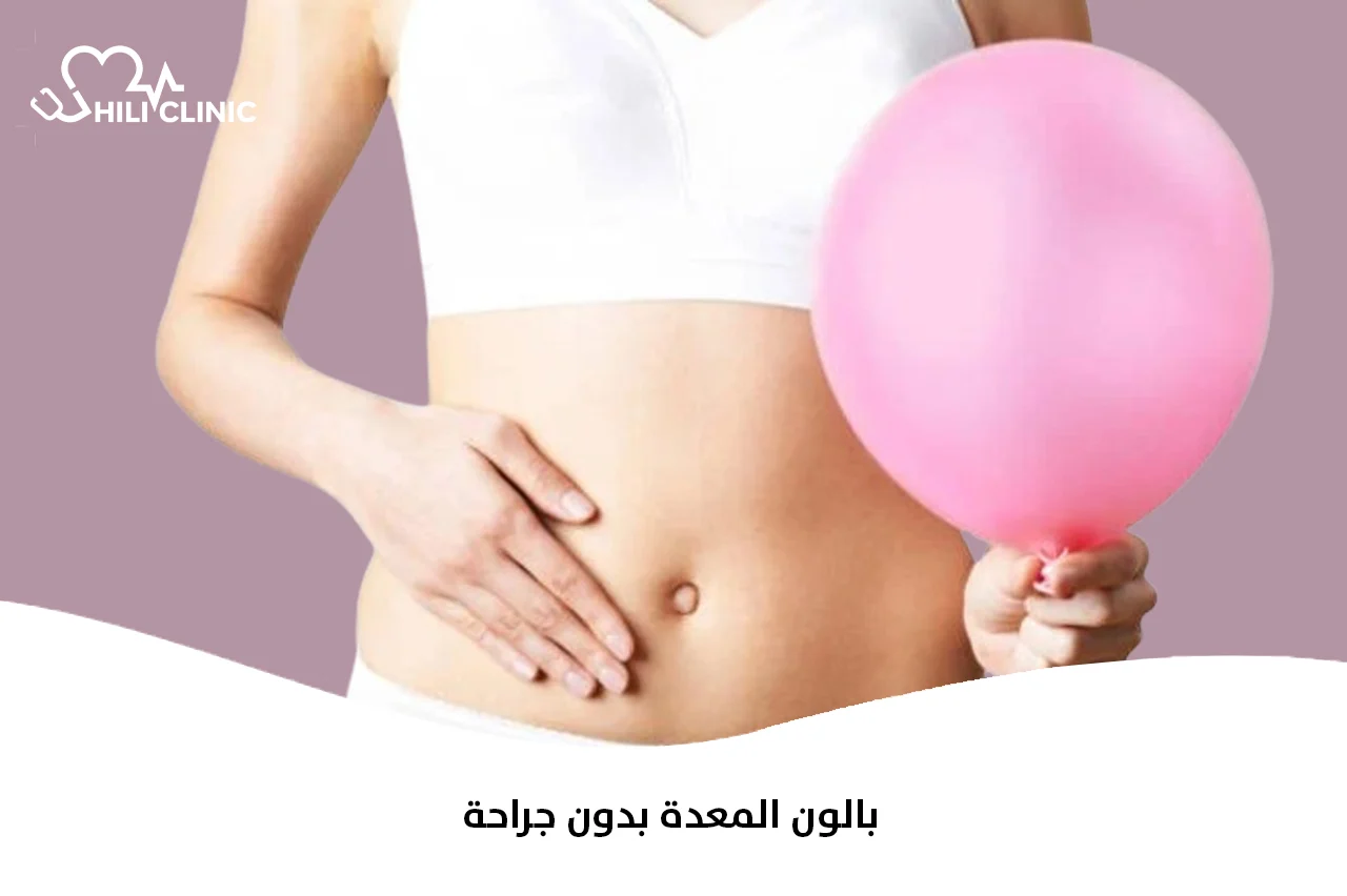 بالون المعدة بدون جراحة