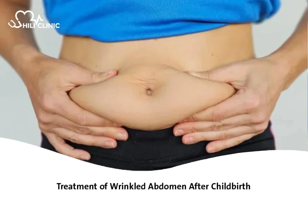 Treatment of Wrinkled Abdomen After Childbirth