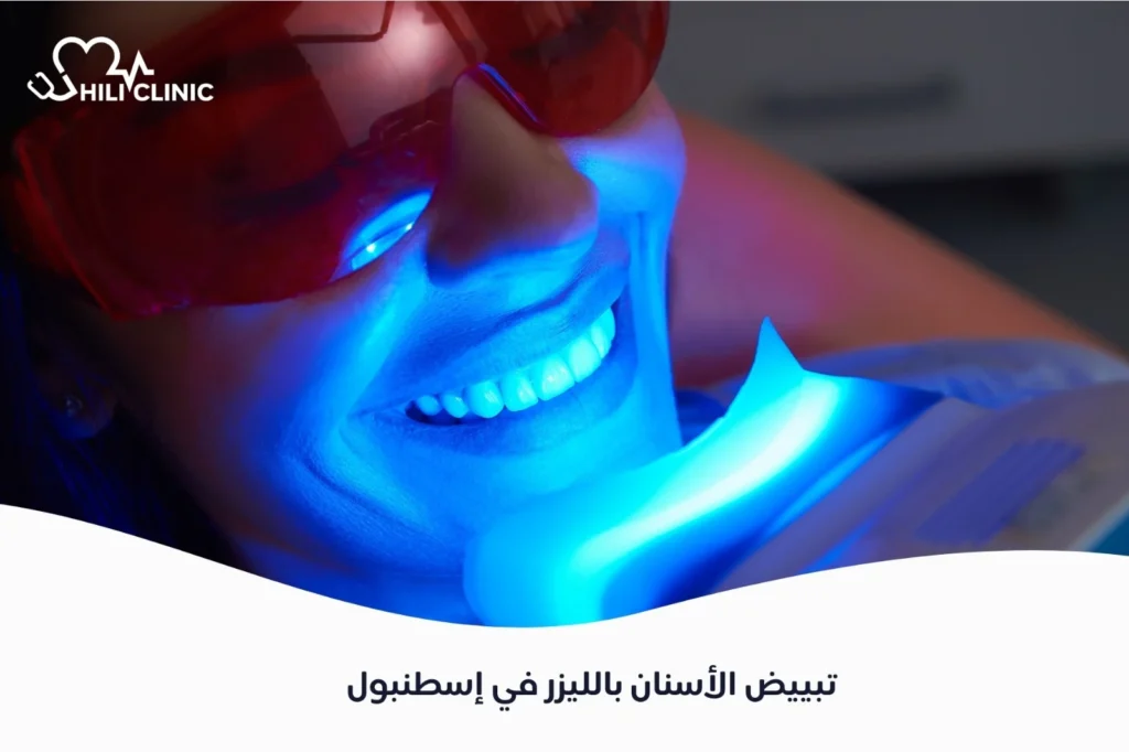 تبييض الأسنان بالليزر في إسطنبول