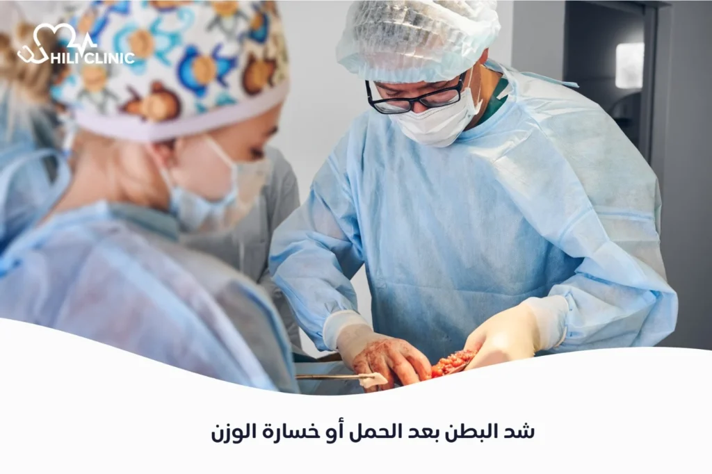 شد البطن بعد الحمل أو خسارة الوزن