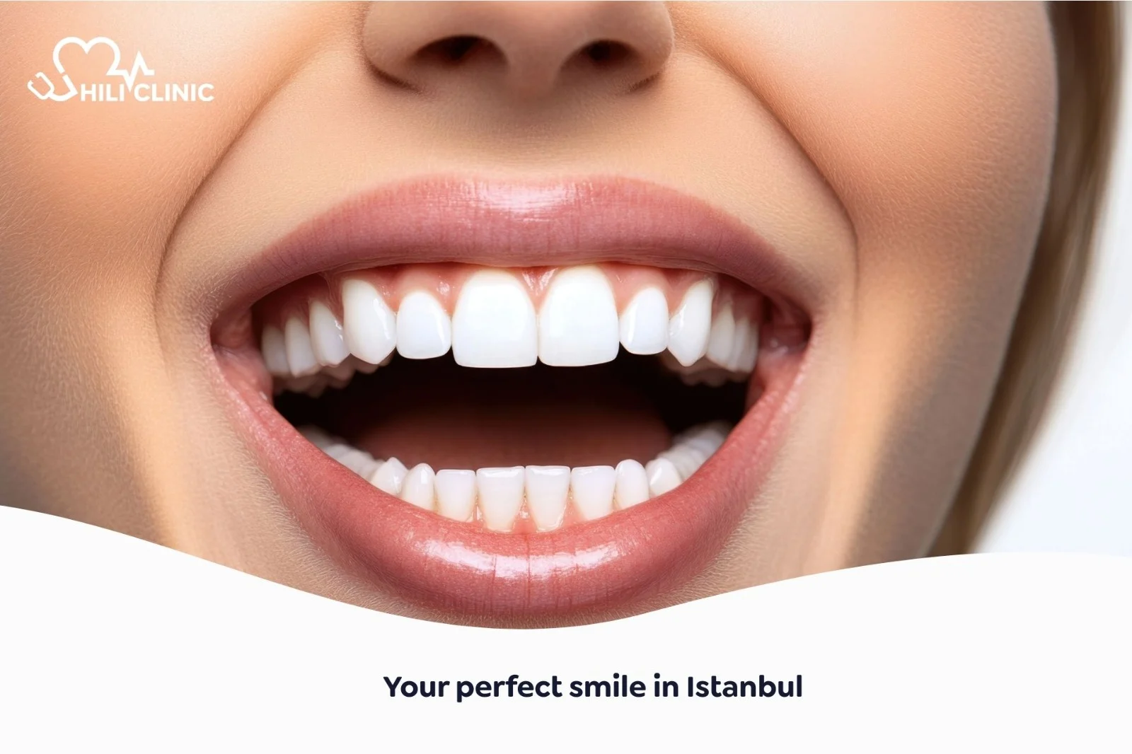 Your Perfect Smile in Istanbul