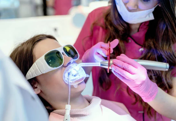 مدة ظهور نتيجة تبييض الأسنان بالليزر