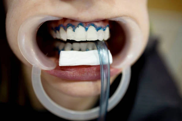 Zirconia Crowns in Turkey