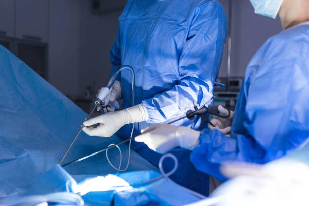 Conditions for Gastric Sleeve Surgery