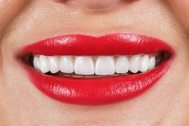 Hollywood Smile in Turkey: Types, Steps, Types 2025