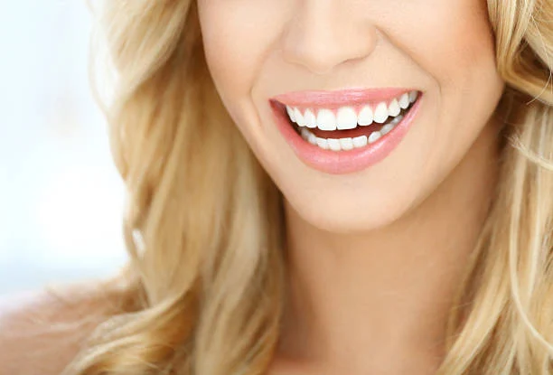 Hollywood Smile in Turkey: Types, Steps, Types 2025