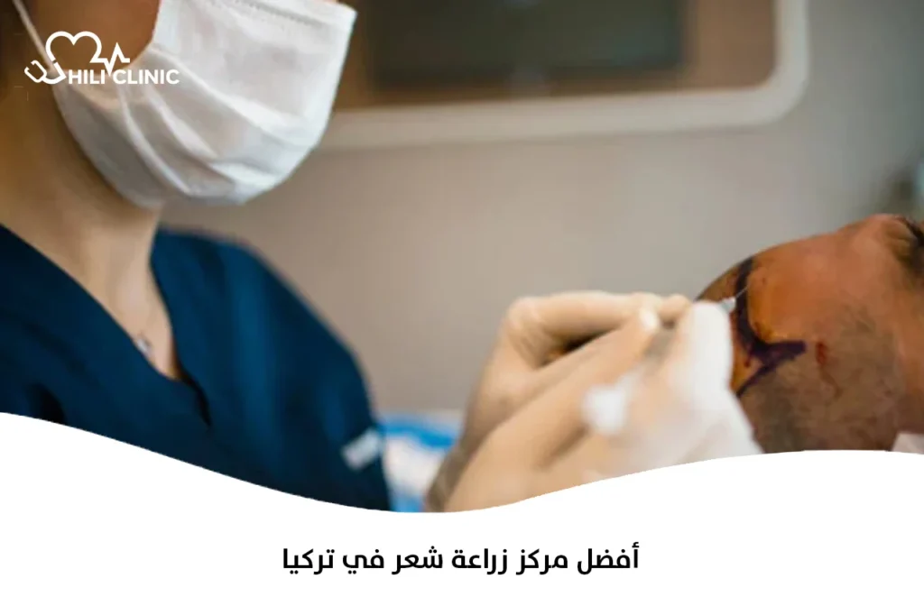 أفضل مركز زراعة شعر في تركيا