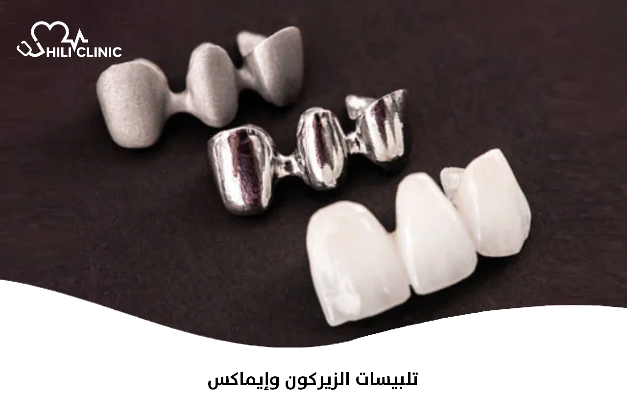 تلبيسات الزيركون وإيماكس