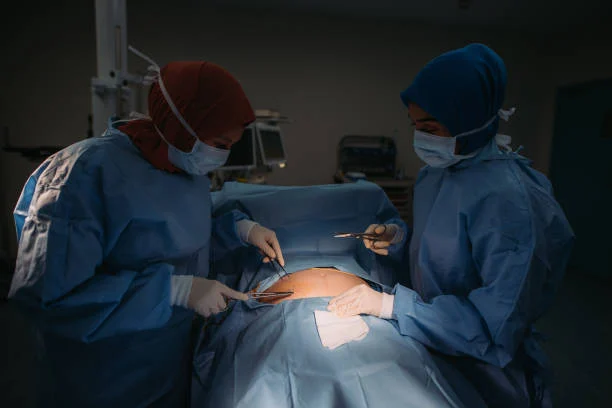 خطوات العملية الجراحية