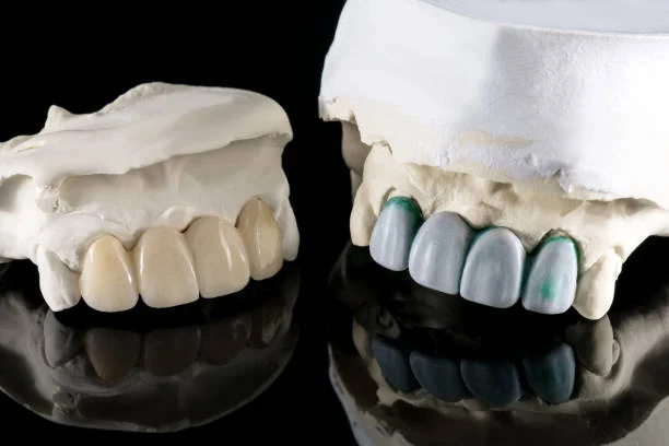 أسعار التلبيسات في تركيا