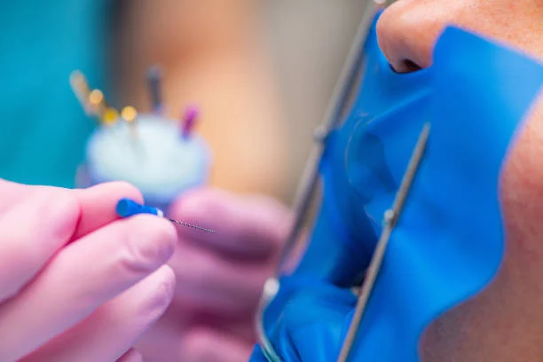 Types of Cosmetic Fillings