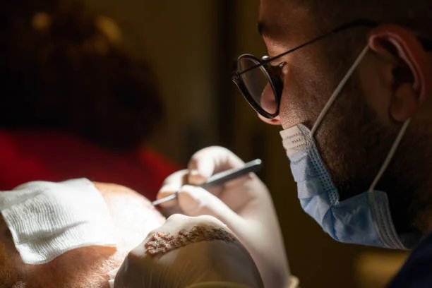 نسبة نجاح الزراعة