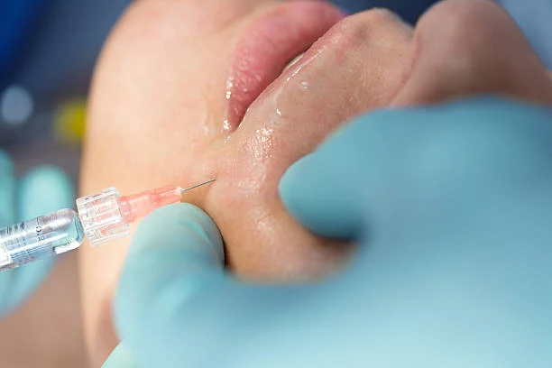 Common Injection Areas