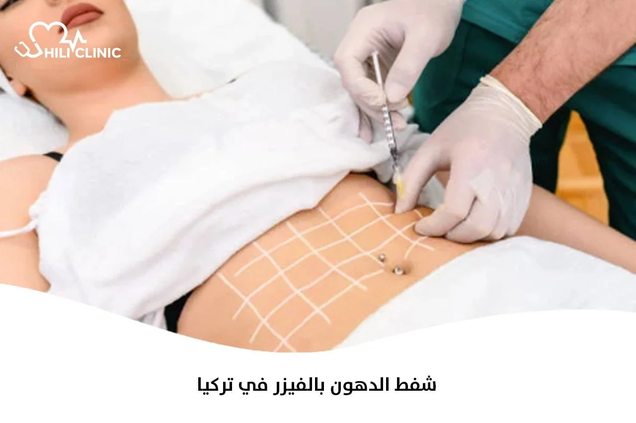 شفط الدهون بالفيزر في تركيا
