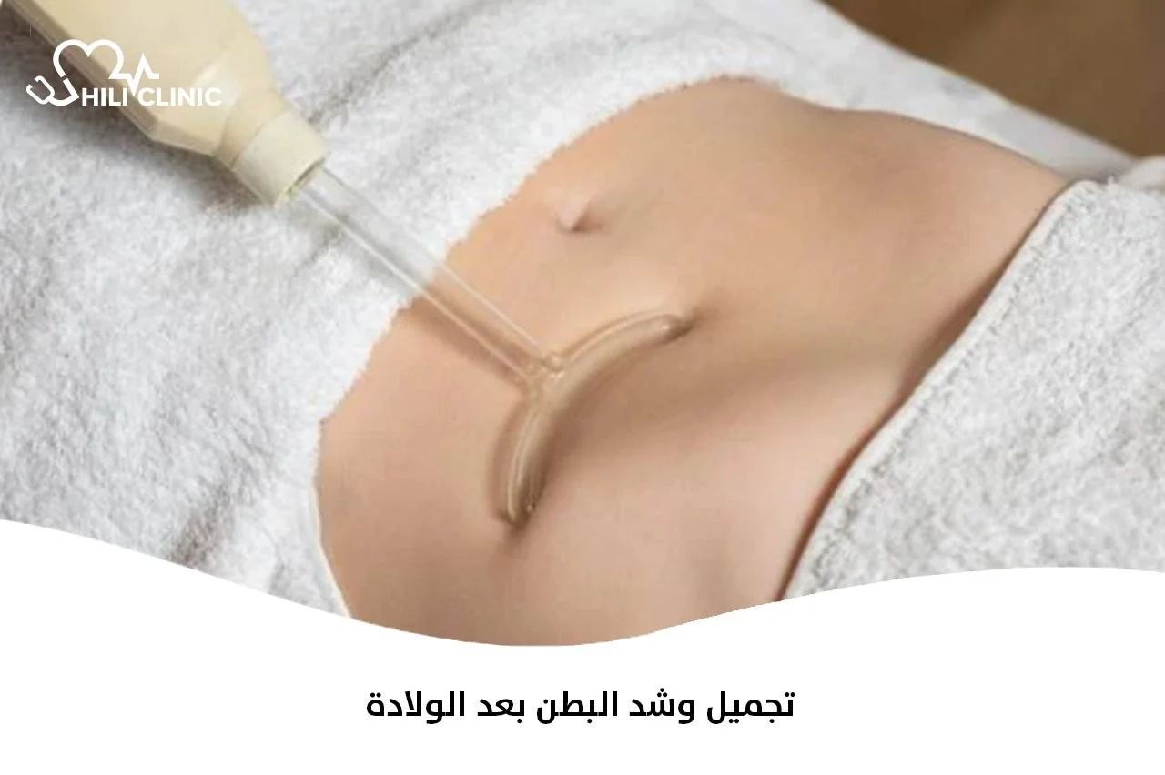 تجميل وشد البطن بعد الولادة