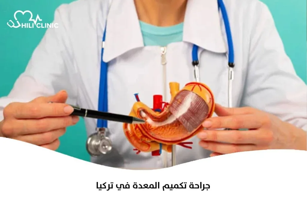 جراحة تكميم المعدة في تركيا