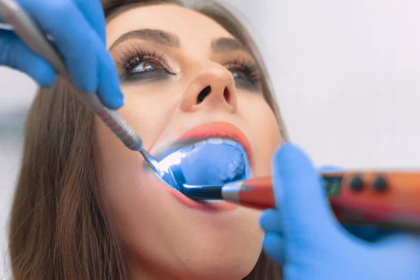 When Do You Need a Filling