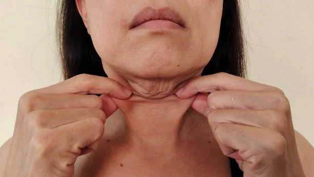 Double Chin Removal Without Pain