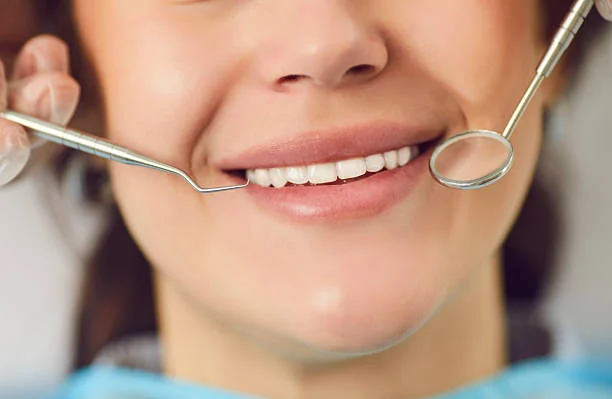 Digital Smile Design