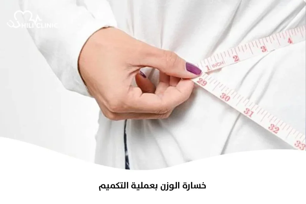 خسارة الوزن بعملية التكميم