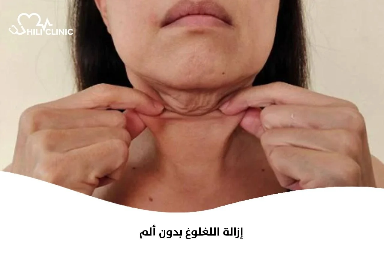 إزالة اللغلوغ بدون ألم