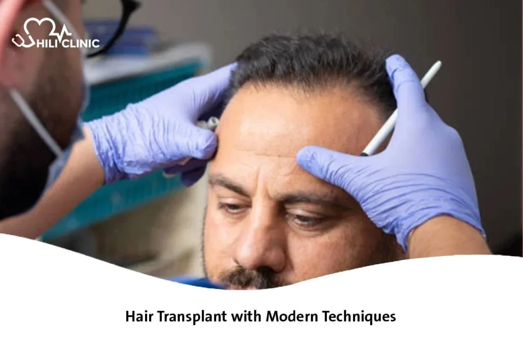 Hair Transplant with Modern Techniques