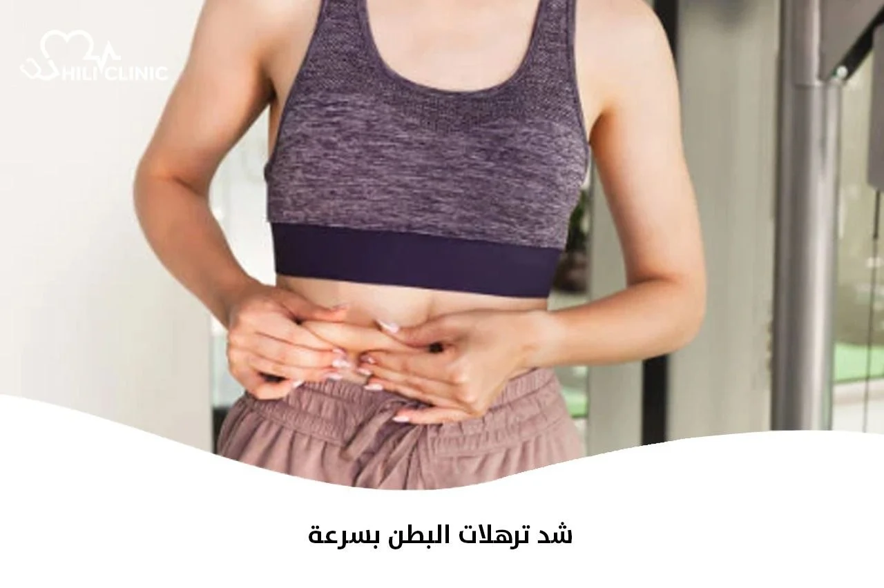 شد ترهلات البطن بسرعة