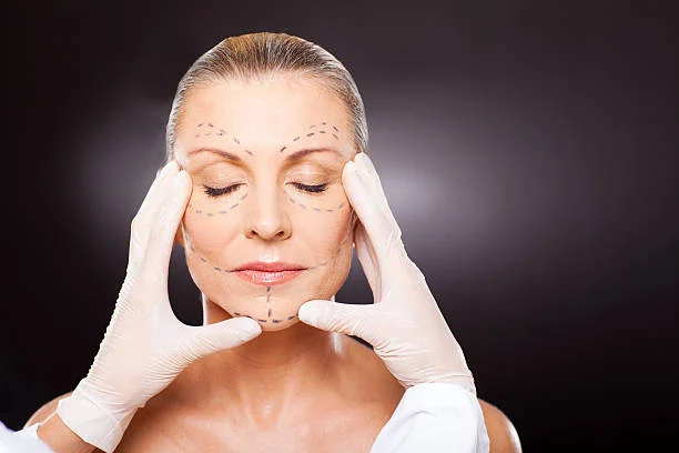 Facelift Without Surgery