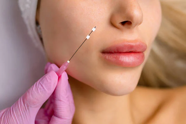 Facial Fillers: Uses and Before & After Results