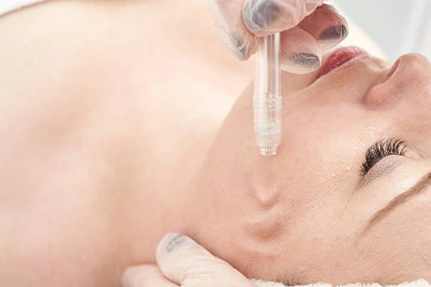 What Are the Best Types of Glow Injections?