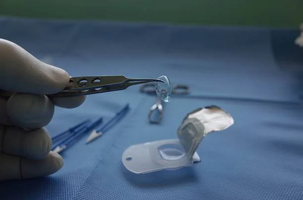 When Do We Need Lens Implantation?