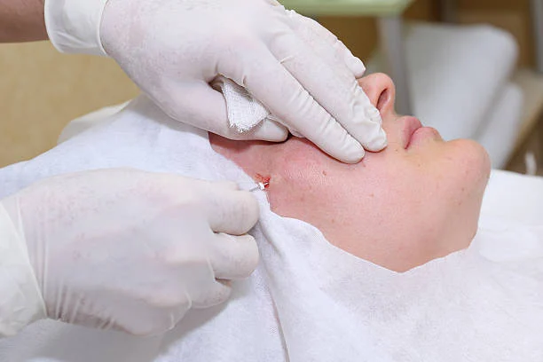 Skin Glow Injection: Results and Effectiveness 2026