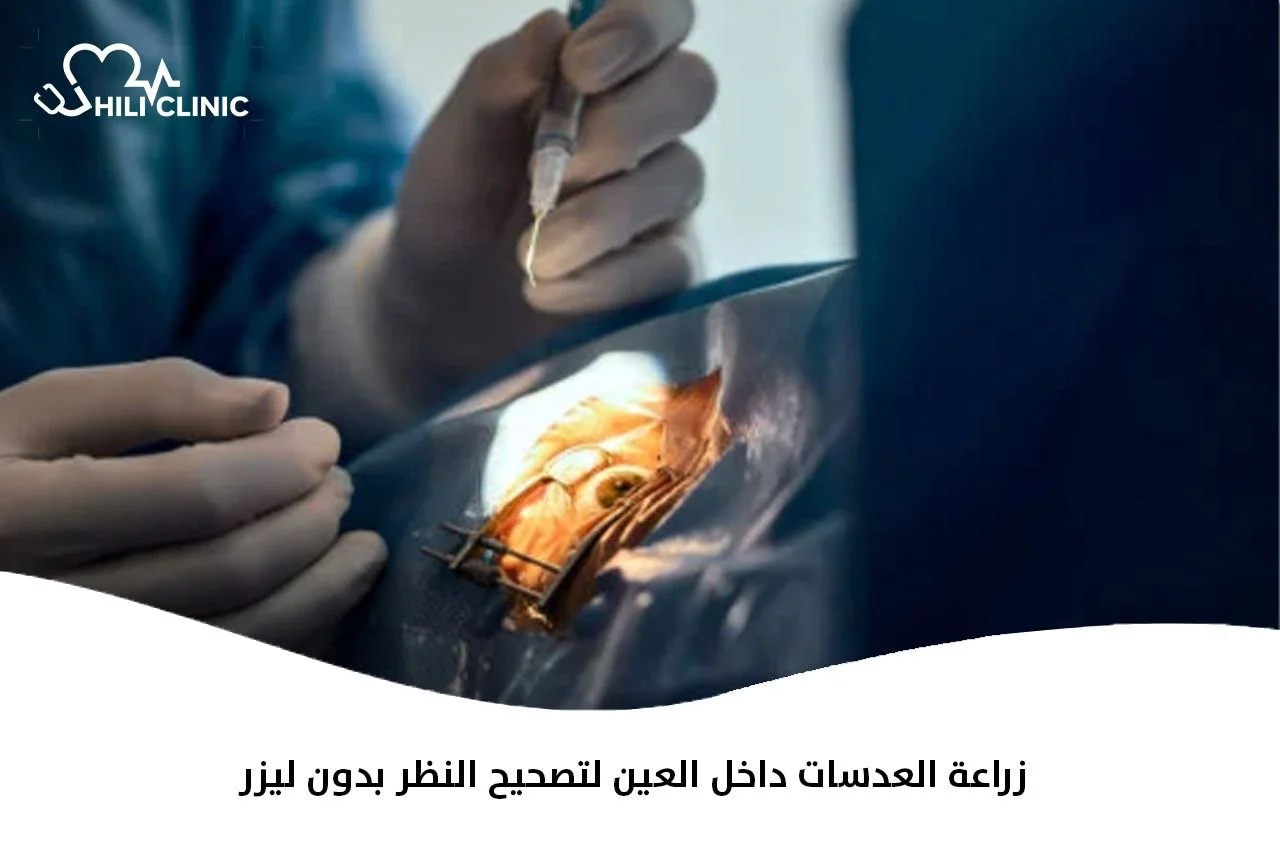 زراعة العدسات داخل العين لتصحيح النظر بدون ليزر 2026