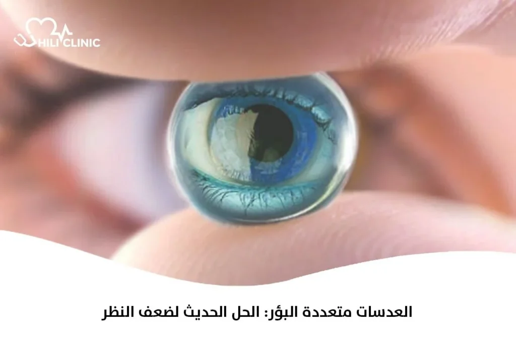 العدسات متعددة البؤر