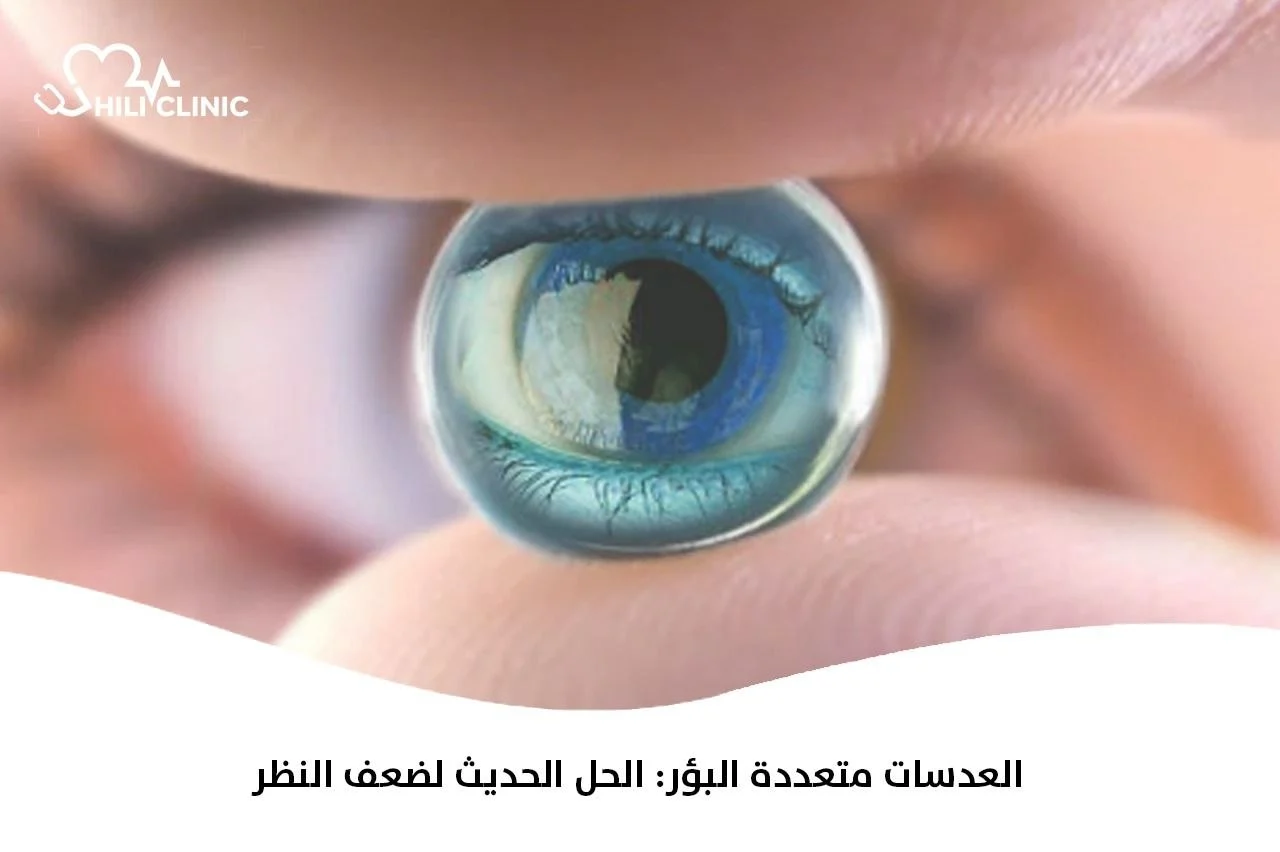 العدسات متعددة البؤر