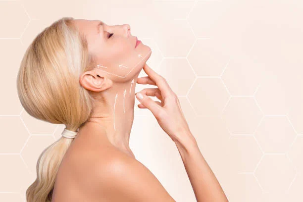 Benefits of a facelift