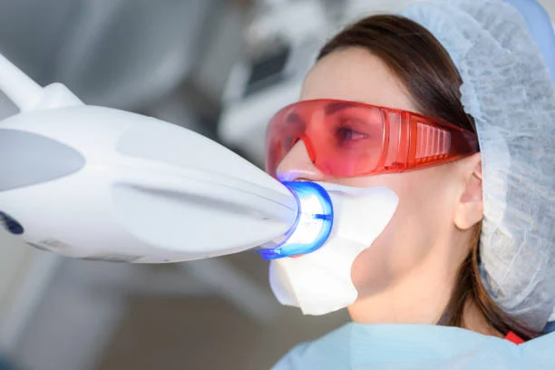 Benefits of Laser Whitening