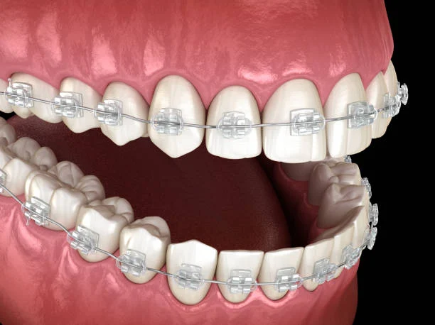 Treatment duration