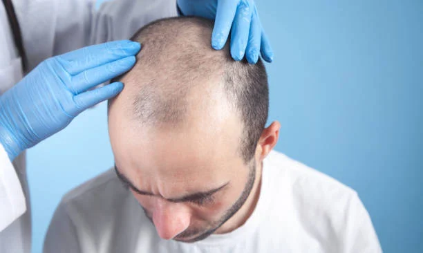 What is the DHI technique?