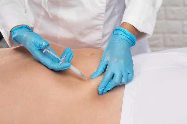 Steps of Body Fat Transfer Injections