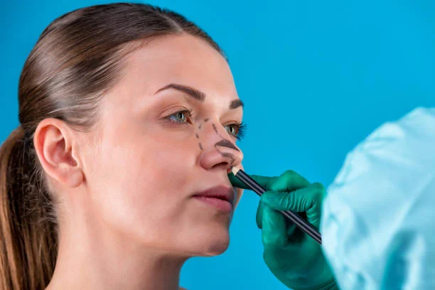 Why rhinoplasty in Turkey is so popular