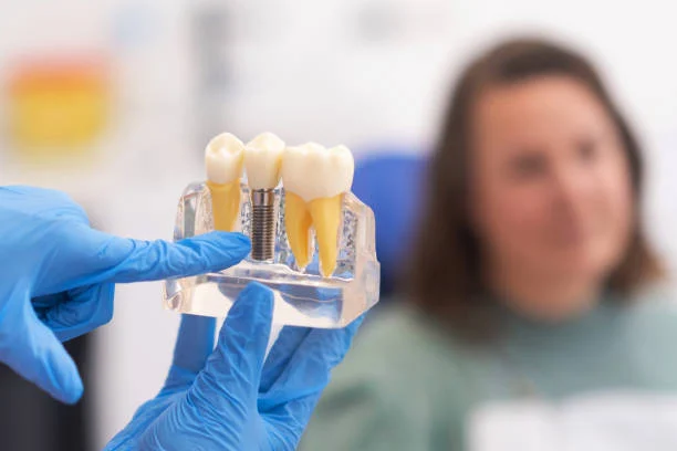 Conditions for immediate implantation