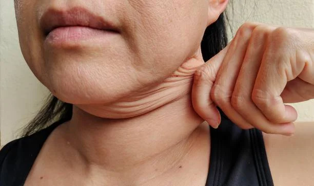 Double Chin Reduction (Submental Fat): Latest Techniques and Results
