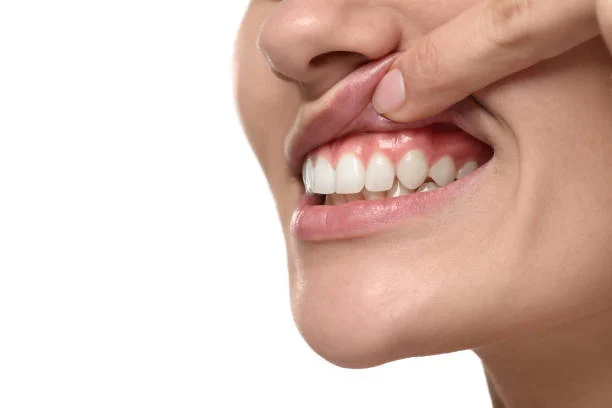 نتائج العلاج التجميلية