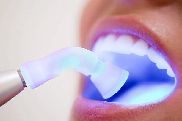 Do Cosmetic Fillings Last Long?