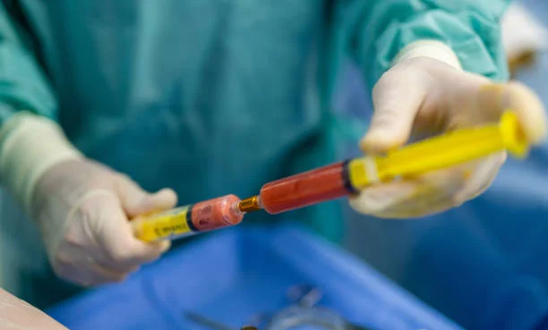 Body Fat Transfer Injections