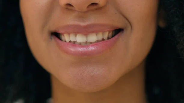 Best Types of Hollywood Smile: Difference Between Veneers and Lumineers