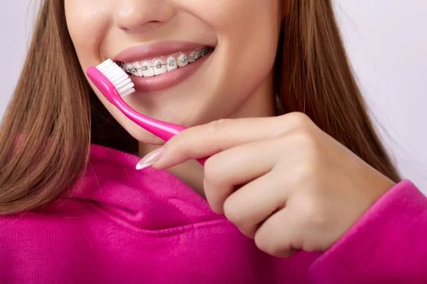 Difference from metal braces