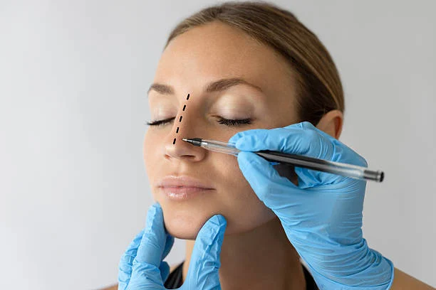 What is non-surgical rhinoplasty?